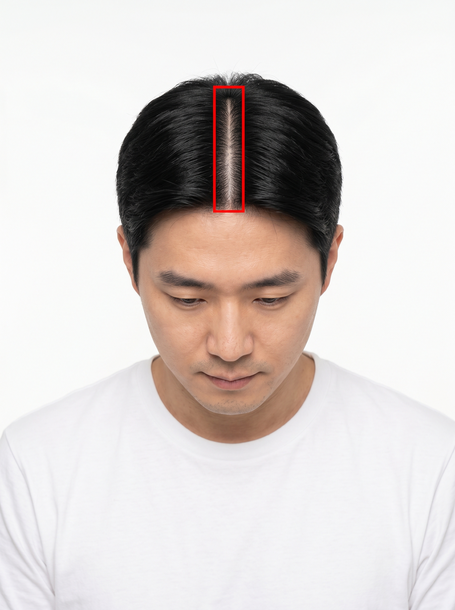 정중선